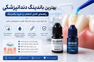 باندینگ دندانپزشکی
