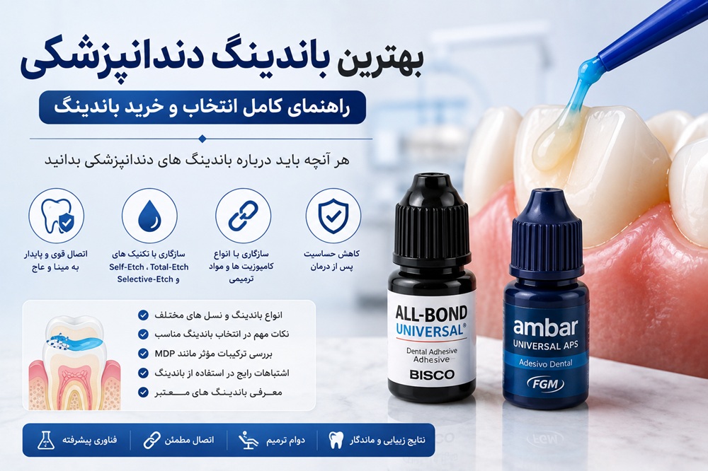 باندینگ دندانپزشکی