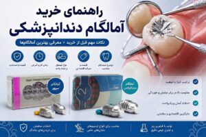 آمالگام دندانپزشکی